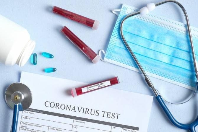 U Srpskoj još 81 osoba zaražena, preminuo Banjalučanin