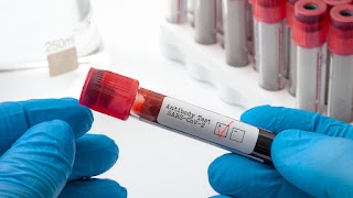 Kako saznati pravo stanje antitijela nakon vakcinacije ili preležane korone?