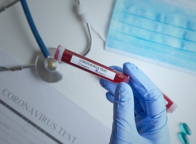 NEMA PREMINULIH: U Srpskoj zaraženo 139 osoba