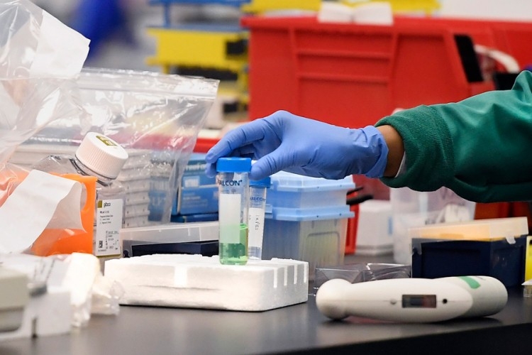 PREMINULA 24 PACIJENTA Na virus korona pozitivno još 232 građana Srpske