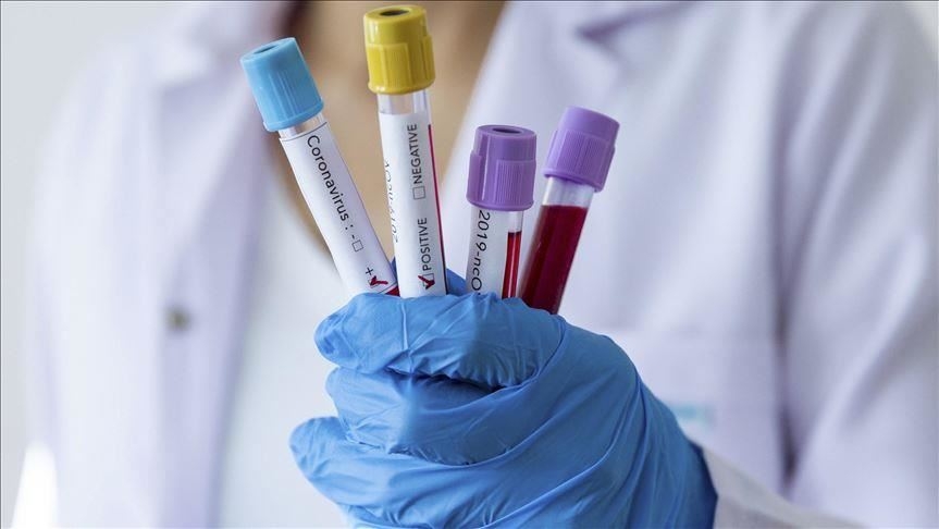 U Srpskoj još 51 osoba oboljela od virusa korona