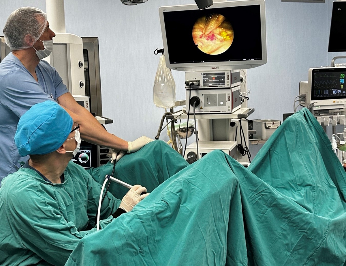 DOBOJ: Prvi put obavljena cistolitotripsija