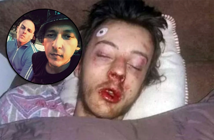 DEMANT PU DOBOJ: Lažne optužbe u slučaju nanošenja teških tjelesnih povreda Bogdanu Rakiću