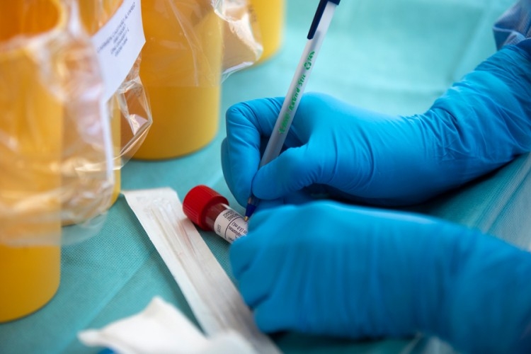 KORONA ODNIJELA PET ŽIVOTA Testiranje otkrilo još 47 zaraženih osoba