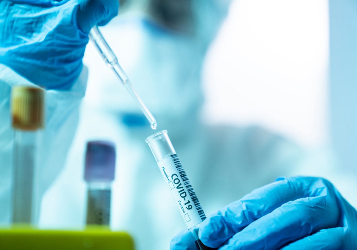 DESETORO PREMINULIH U Srpskoj još 186 osoba zaraženo korona virusom