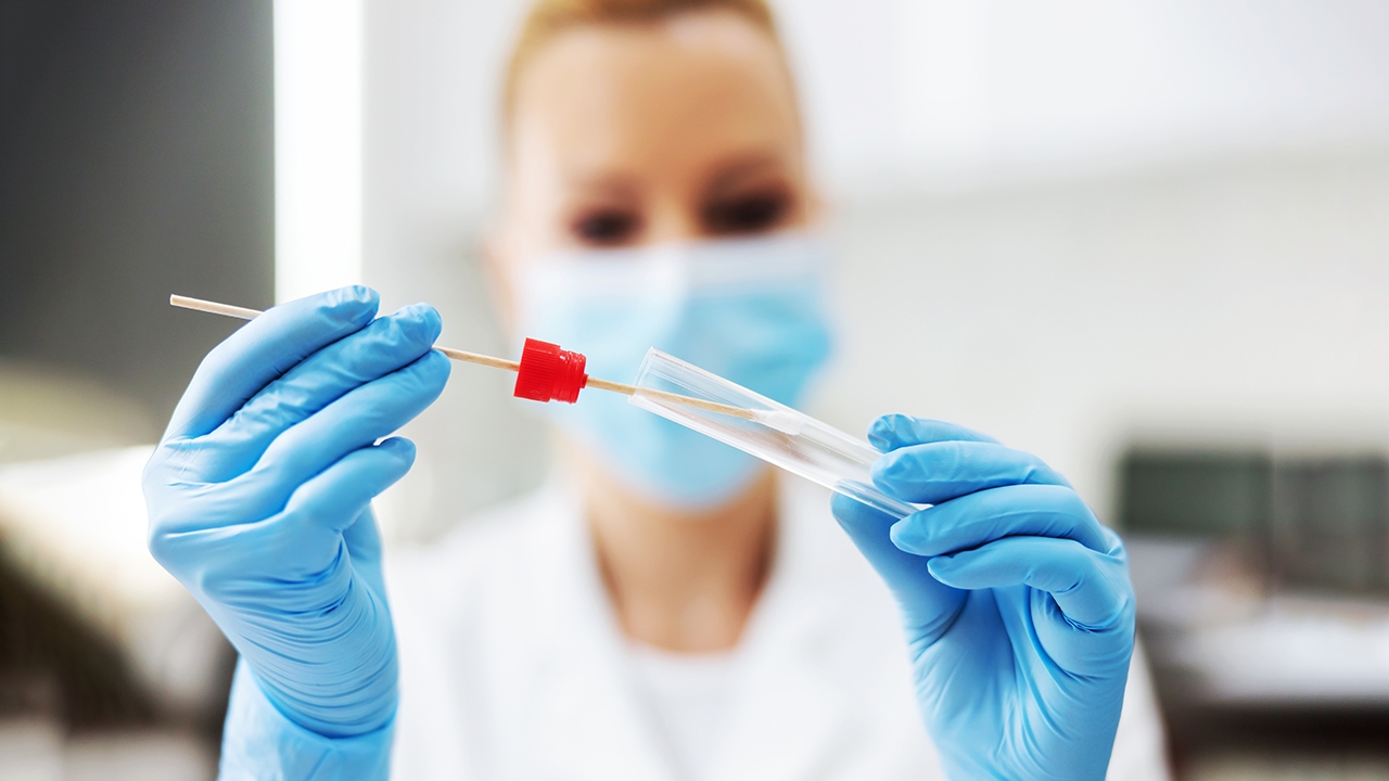 BOLNICA DOBOJ: Obaviještenje o promjeni termina PCR testiranja