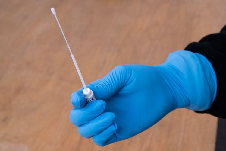 U Srpskoj 23 nova slučaja virusa korona