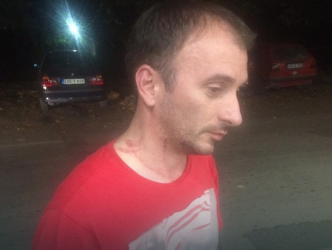 TRAŽIO PLATU PA DOBIO BATINE Teslićki biznismen Milorad Slavuljica pretukao radnika