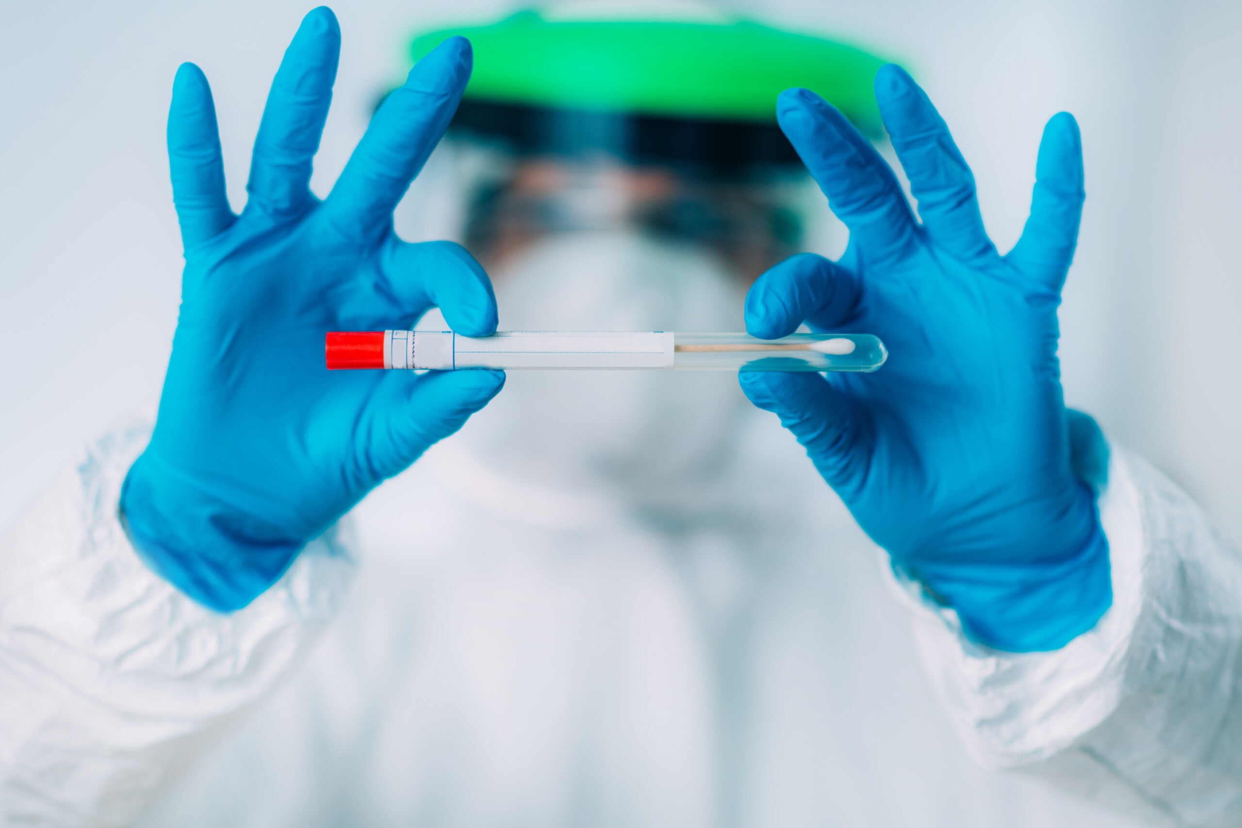 BOLNICA DOBOJ: Od ponedjeljka obavezno zakazivanje termina za PCR testiranje