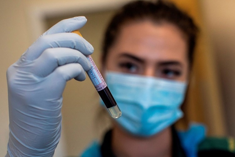 Preminule četiri osobe zaražene koronom u RS, 95 novih slučajeva