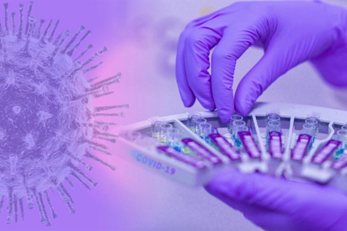 U Srpskoj zaraženo deset osoba, preminula starija žena iz Doboja