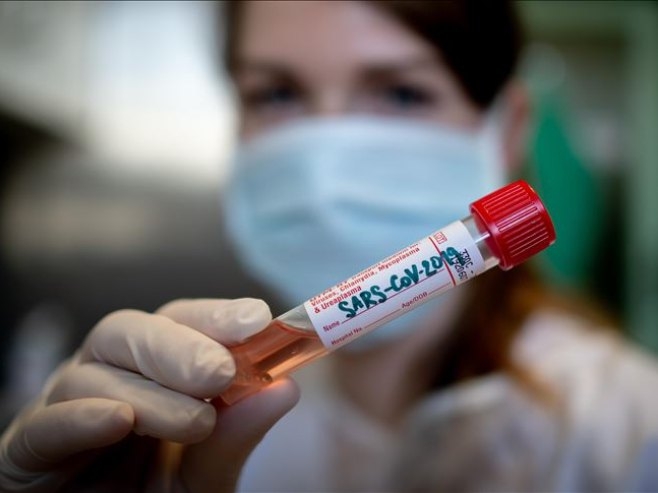 DOBOJ: Pet novih slučaja zaraze virusom korona