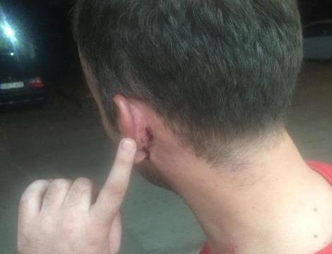 DOBOJ: Otac, sin i zet prijavljeni za premlaćivanje radnika