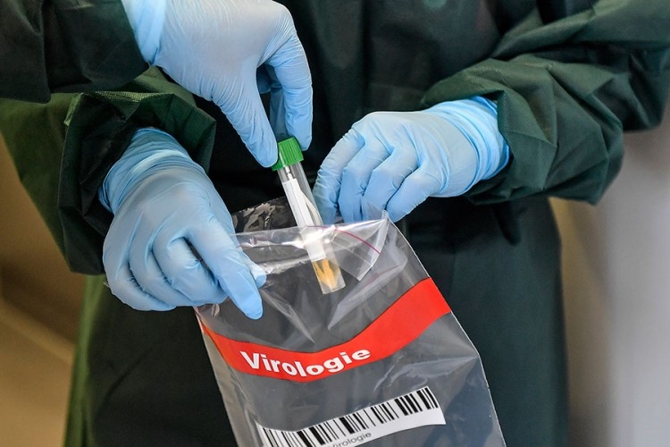 KORONA NE JENJAVA: Još 35 pozitivnih u Srpskoj