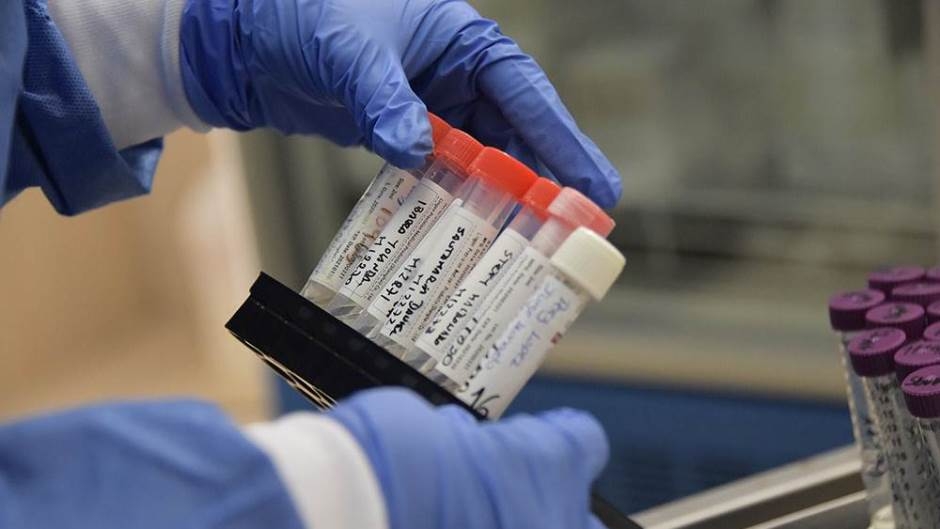 Krvna grupa A i AB pod najvećim rizikom od korone